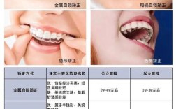武汉牙齿矫正真便宜吗？价格靠谱还是陷阱？