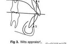 正畸Wits值正常值具体范围是多少？