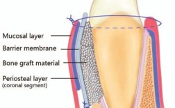 牙周加速骨源性正畸学