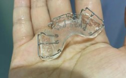 轻微地包天 正畸