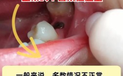 种牙钉周围肿疼是什么原因？该怎么处理？