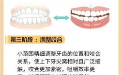 牙齿正畸最快多久