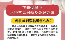 正畸连续结扎方法如何提升结扎效率与效果？