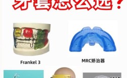 儿童正畸哪儿做的好