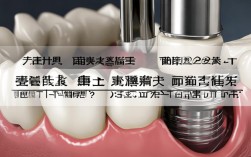 现在种植牙技术发展得怎么样？效果安全吗？能用多久吗？值得选吗？