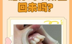 最快纠正龅牙的方法有哪些？哪种最有效？