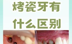 种植牙危害被科瓦权威提及？是真的吗？
