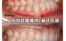 上口腔牙齿矫正