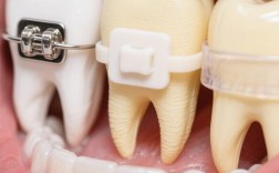 常州矫正牙齿哪家好？优质靠谱机构怎么选？