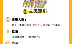 正畸橡皮圈三角挂法是什么？如何正确操作？