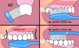 正畸患者戴牙套，刷牙的正确方法是什么？