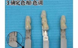 口腔比色仪的分类方法具体包含哪些分类标准和类型？