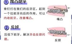 正畸支抗钉受力时间多长效果最佳？对矫治效果有何影响？