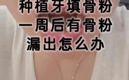 骨粉植牙失败，背后原因究竟是什么？