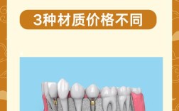 昆明雅度口腔优惠种牙