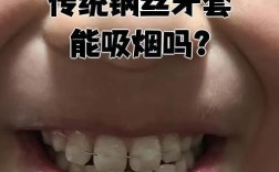 矫正牙齿期间抽烟，可以吗？会有哪些危害？
