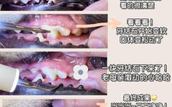 清除牙结石的好方法有哪些？不同人群如何选择安全有效的方案，日常护理能替代专业洗牙吗？