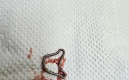 正畸带环上的东西掉了该怎么办？