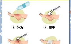 如何正确消毒牙科挫针？