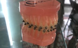 北海牙博士牙齿矫正怎么样？效果、价格和服务如何？