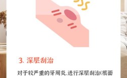 牙周炎中期如何治疗？有哪些有效方法及注意事项？