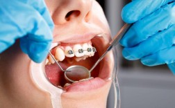 做过口腔正畸的人