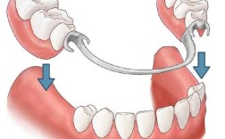 拥挤牙齿结扎的有效方法有哪些？详细操作步骤是怎样的？