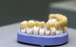 种牙后牙冠选什么材质？不同材质优缺点如何挑选合适？