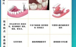 假牙跟种牙区别