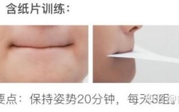 正畸者唇肌训练方法有哪些科学有效的具体步骤？