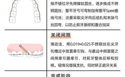 正畸弓丝更换顺序有何讲究？不同阶段为何这样换？