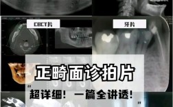 正畸拍什么片多少钱