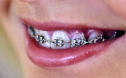 keynote助力正畸医生，如何实现高效病例演示？