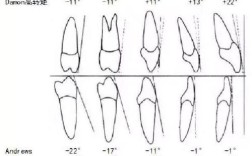 正畸标准转矩角度的标准是什么？临床应用有何关键？