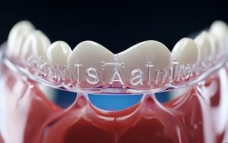 2025隐形矫正效果真那么好？