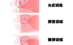 正畸唇舌肌训练抿嘴图有何具体作用？