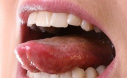 正畸前几天舌头特别苦