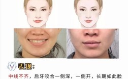 矫正牙齿多久脸型会发生变化？