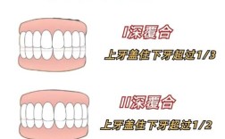 深覆合矫正有哪些方法？不同矫正方式有何区别？