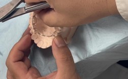 正畸TPA弯制方法有哪些关键步骤与操作技巧？