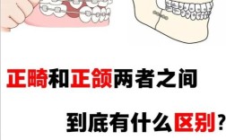正颌前正畸经过