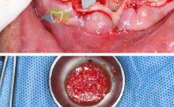 种牙骨可能出现哪些不良反应？这些反应的产生原因是什么？如何科学应对并有效降低发生风险？