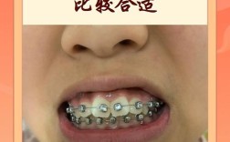 小孩矫正牙齿的最佳年龄是几岁？