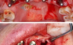 牙齿矫正为何会引起牙齿创伤？