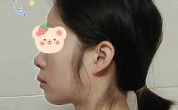 光华口腔医院 正畸