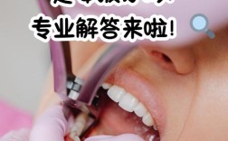 正畸治疗中必须拔掉虎牙吗？拔除虎牙会对面部美观和咀嚼功能造成哪些影响？