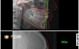 正畸头影测量多分软件如何提升诊断精准度？
