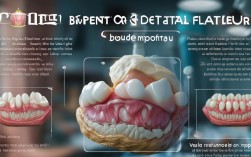 种植牙失败六大原因，你真的清楚吗？
