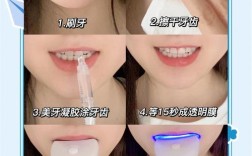 一天牙齿美白方法真的靠谱吗？这些步骤安全吗？效果能持续多久？