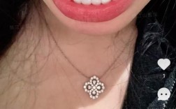 后牙舌侧倾斜正畸